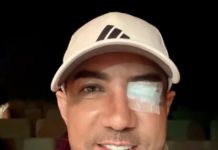 Marcos Yaroide revela que fue operado de emergencia por desprendimiento de retina